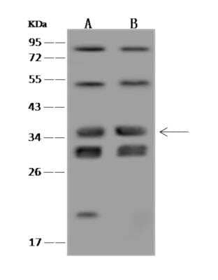 Western Blot: VPS37B Antibody [NBP3-06284]