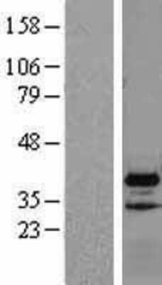 Western Blot: VPS37B Overexpression Lysate [NBL1-17749]