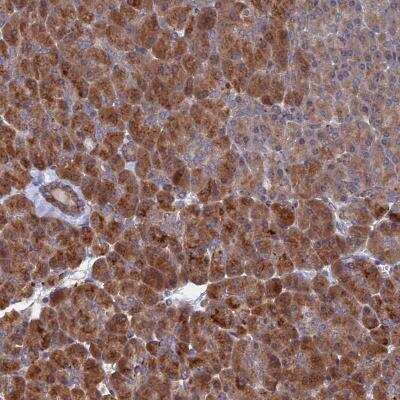 Immunohistochemistry-Paraffin: VPS37C Antibody [NBP1-83632]