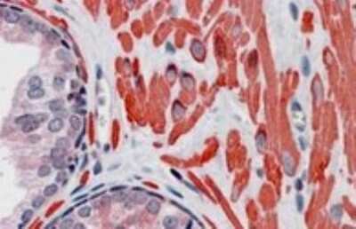 Immunohistochemistry-Paraffin: VPS37C Antibody [NB100-2438]