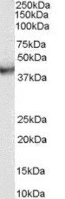 Western Blot: VPS37C Antibody [NB100-2438]