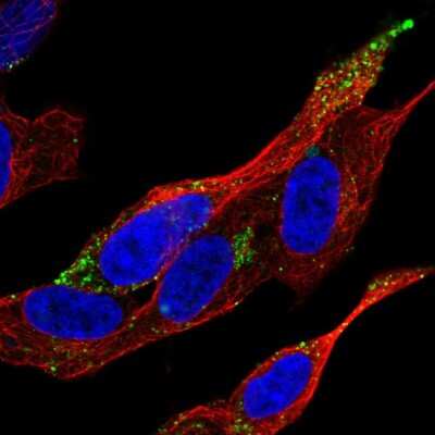 Immunocytochemistry/ Immunofluorescence: VPS37D Antibody [NBP1-93480]