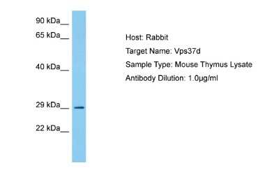 Western Blot: VPS37D Antibody [NBP2-83753]