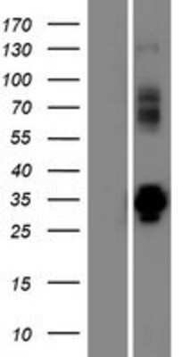 Western Blot: VPS37D Overexpression Lysate [NBP2-08464]