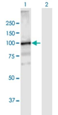 Western Blot: VPS39 Antibody [H00023339-B01P]