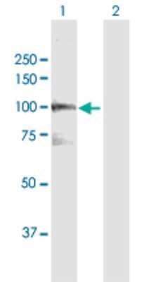 Western Blot: VPS39 Antibody [H00023339-D01P]