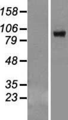 Western Blot: VPS39 Overexpression Lysate [NBL1-17750]