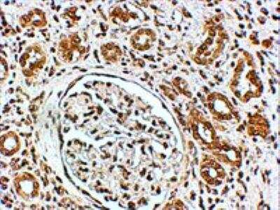 Immunohistochemistry-Paraffin: VPS41 Antibody [NB100-2425]