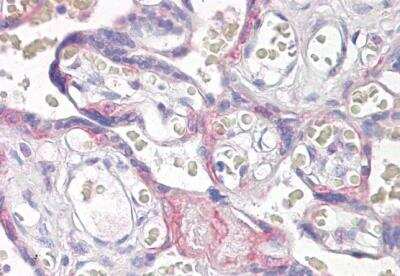 Immunohistochemistry-Paraffin: VPS41 Antibody [NB100-2425]