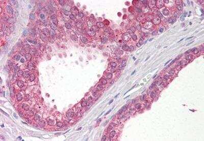 Immunohistochemistry-Paraffin: VPS41 Antibody [NB100-2425]