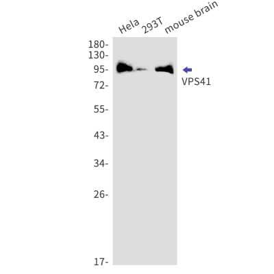 Western Blot: VPS41 Antibody (S08-1J7) [NBP3-15109]