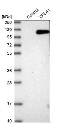 Western Blot: VPS41 Antibody [NBP1-81640]