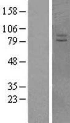 Western Blot: VPS41 Overexpression Lysate [NBL1-17751]