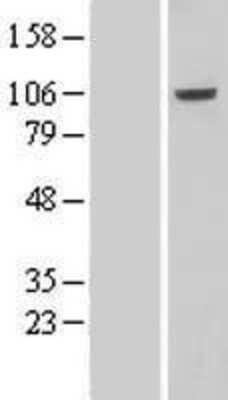 Western Blot: VPS41 Overexpression Lysate [NBL1-17752]