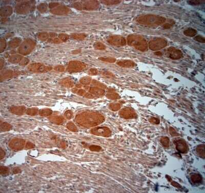 Immunohistochemistry-Paraffin: VPS45 Antibody - Azide and BSA Free [NB100-98931]