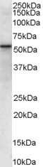 Western Blot: VPS45 Antibody [NB100-2431]