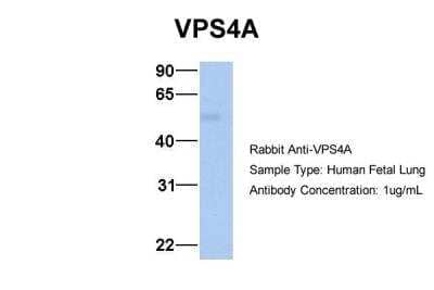 Western Blot: VPS4A Antibody [NBP1-54618]