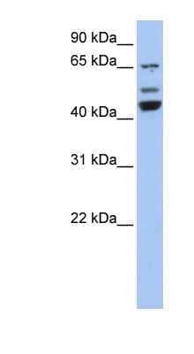 Western Blot: VPS4A Antibody [NBP1-55140]