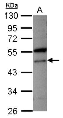 Western Blot: VPS4A Antibody [NBP2-20879]