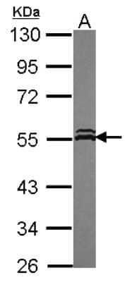 Western Blot: VPS4A Antibody [NBP2-20880]