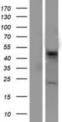 Western Blot: VPS4A Overexpression Lysate [NBP2-07430]