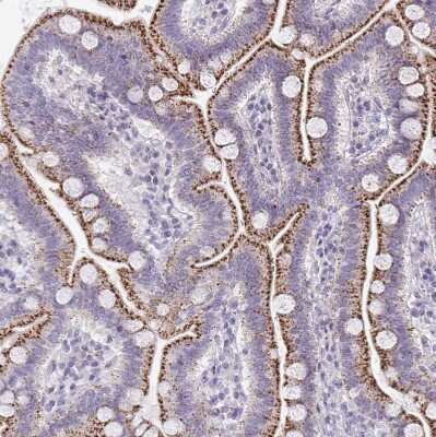 Immunohistochemistry-Paraffin: VPS4B Antibody [NBP2-49263]