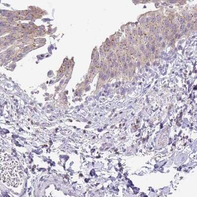 Immunohistochemistry-Paraffin: VPS4B Antibody [NBP2-49263]