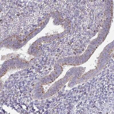 Immunohistochemistry-Paraffin: VPS4B Antibody [NBP2-49263]