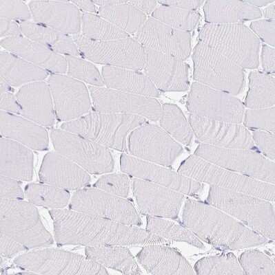 Immunohistochemistry-Paraffin: VPS4B Antibody [NBP2-49263]