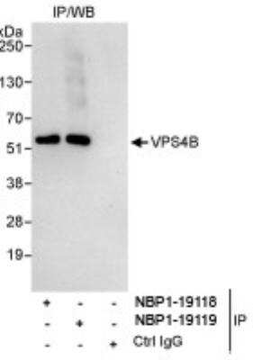 Immunoprecipitation: VPS4B Antibody [NBP1-19118]