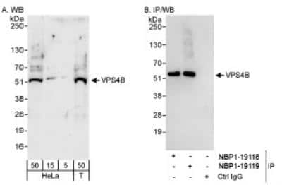 Western Blot: VPS4B Antibody [NBP1-19119]