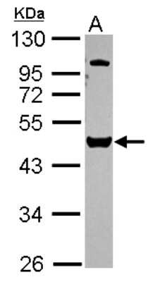 Western Blot: VPS4B Antibody [NBP2-20881]