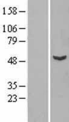 Western Blot: VPS4B Overexpression Lysate [NBL1-17755]