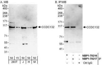 Western Blot: VPS50 Antibody [NBP1-78216]