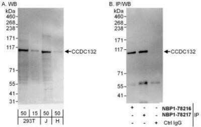 Western Blot: VPS50 Antibody [NBP1-78217]