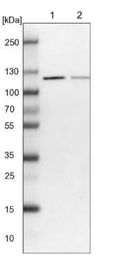 Western Blot: VPS50 Antibody [NBP1-88012]