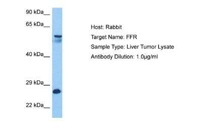 Western Blot: VPS51 Antibody [NBP2-86057]