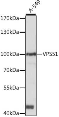 Western Blot: VPS51 AntibodyAzide and BSA Free [NBP2-93344]