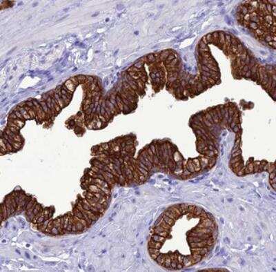 Immunohistochemistry: VPS52 Antibody [NBP2-30418]