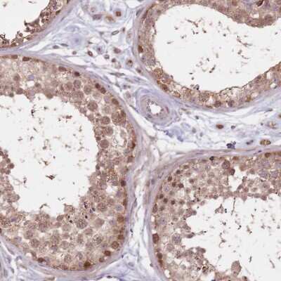 Immunohistochemistry-Paraffin: VPS52 Antibody [NBP2-30721]