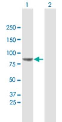 Western Blot: VPS52 Antibody [H00006293-B01P]