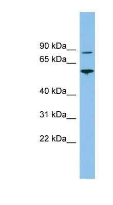 Western Blot: VPS52 Antibody [NBP1-57628]