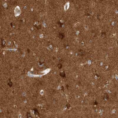 Immunohistochemistry-Paraffin: VPS53 Antibody [NBP1-83798]