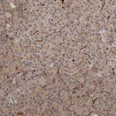 Immunohistochemistry-Paraffin: VPS53 Antibody [NBP1-83798]