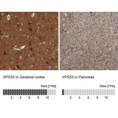 Immunohistochemistry-Paraffin: VPS53 Antibody [NBP1-83798]