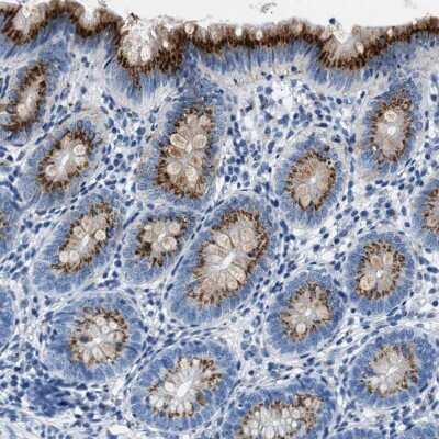 Immunohistochemistry-Paraffin: VPS53 Antibody [NBP1-83799]