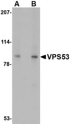 Western Blot: VPS53 AntibodyBSA Free [NBP1-76901]