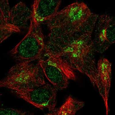 Immunocytochemistry/ Immunofluorescence: VPS54 Antibody [NBP2-57268]