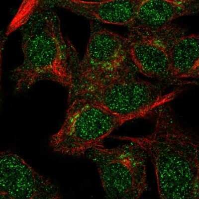 Immunocytochemistry/ Immunofluorescence: VPS54 Antibody [NBP2-57640]