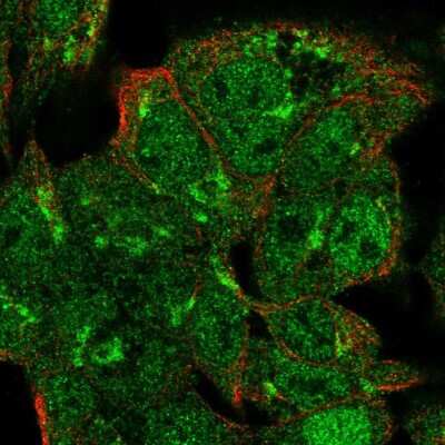 Immunocytochemistry/ Immunofluorescence: VPS54 Antibody [NBP2-58379]